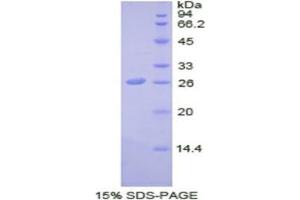 SDS-PAGE analysis of Human SDF4 Protein. (SDF4 Protein)