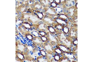 Immunohistochemistry of paraffin-embedded Mouse kidney using TMX2 Rabbit pAb (ABIN7270810) at dilution of 1:100 (40x lens). (TMX2 Antikörper  (AA 128-296))