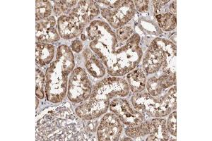 Immunohistochemical staining (Formalin-fixed paraffin-embedded sections) of human kidney with MACC1 polyclonal antibody  shows moderate cytoplasmic positivity in cells in tubules.