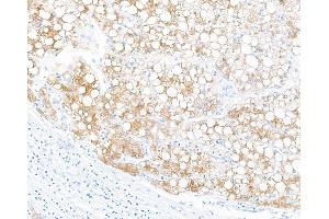 Immunohistochemistry (IHC) image for anti-Fibrinogen-Like 1 (FGL1) (AA 18-312) antibody (ABIN7453972) (Rekombinanter FGL1 Antikörper  (AA 18-312))