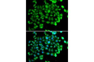 Immunofluorescence analysis of U2OS cells using APOBEC3C antibody (ABIN5973484). (APOBEC3C Antikörper)