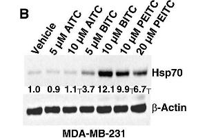 Western Blotting (WB) image for anti-Heat Shock Protein 70 (HSP70) antibody (ABIN361708)