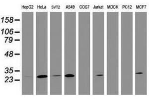 Image no. 2 for anti-B-Cell CLL/lymphoma 10 (BCL10) antibody (ABIN1496850) (BCL10 Antikörper)