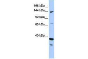 Image no. 1 for anti-DEAH (Asp-Glu-Ala-His) Box Polypeptide 37 (DHX37) (AA 71-120) antibody (ABIN6742694)