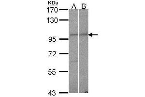WB Image Sample (30 ug of whole cell lysate) A: Hela B: NT2D1 7. (Importin 9 Antikörper  (C-Term))
