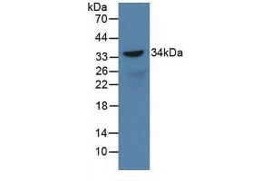 Detection of Recombinant SOX18, Rat using Polyclonal Antibody to Sex Determining Region Y Box Protein 18 (SOX18)