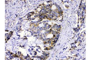 anti-Methylmalonyl Coenzyme A Mutase (MUT) (AA 33-65), (N-Term) antibody