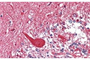 Detection of HEXb in Human Cerebellum Tissue using Polyclonal Antibody to Hexosaminidase B Beta (HEXb)