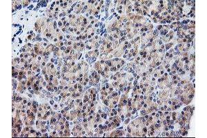 Immunohistochemistry (IHC) image for anti-ATG3 Autophagy Related 3 (ATG3) antibody (ABIN1496760) (ATG3 Antikörper)