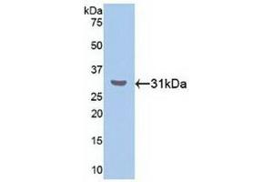 Detection of Recombinant RORa, Human using Polyclonal Antibody to RAR Related Orphan Receptor Alpha (RORa) (RORA Antikörper  (AA 164-401))