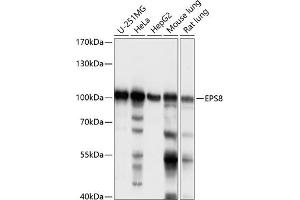 Western blot analysis of extracts of various cell lines, using EPS8 antibody (ABIN7266992) at 1:1000 dilution. (EPS8 Antikörper  (AA 1-200))
