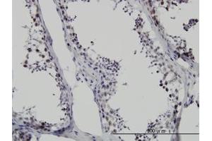 Image no. 1 for anti-Survival Motor Neuron Domain Containing 1 (SMNDC1) (AA 1-239) antibody (ABIN599128) (SMNDC1 Antikörper  (AA 1-239))