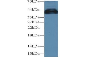 Detection of UCP4 in Mouse Cerebrum lysate using Polyclonal Antibody to Uncoupling Protein 4, Mitochondrial (UCP4) (SLC25A27 Antikörper  (AA 21-317))