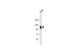 Anti-CYLD Antibody at 1:4000 dilution + Hela whole cell lysate Lysates/proteins at 20 μg per lane. (CYLD Antikörper  (AA 305-582))