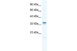 WB Suggested Anti-ANKZF1 Antibody Titration:  0. (ANKZF1 Antikörper  (N-Term))