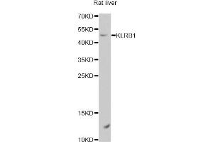 Western blot analysis of extracts of rat liver, using KLRB1 antibody.
