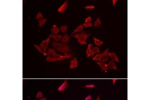 Immunofluorescence analysis of MCF-7 cells using RARRES2 Polyclonal Antibody (Chemerin Antikörper)