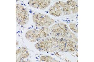 Immunohistochemistry of paraffin-embedded human stomach using MTERFD3 antibody. (MTERFD3 Antikörper  (AA 1-250))
