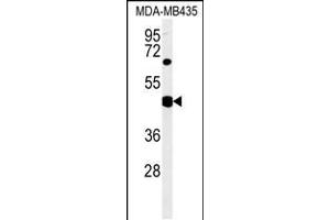 Western blot analysis in MDA-MB435 cell line lysates (35ug/lane). (SH2D2A Antikörper  (AA 86-112))