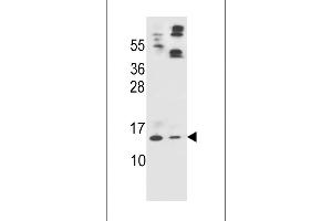 Apolipoprotein C-II Antikörper  (AA 45-73)