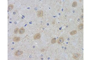 Immunohistochemistry analysis of paraffin-embedded rat brain using DLG4 Polyclonal Antibody at dilution of 1:100. (DLG4 Antikörper)