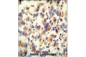 Immunohistochemistry (Paraffin-embedded Sections) (IHC (p)) image for anti-UDP Glycosyltransferase 3 Family, Polypeptide A2 (UGT3A2) (AA 377-405), (C-Term) antibody (ABIN654317)
