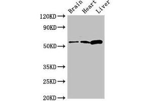 Western Blot Positive WB detected in: Mouse brain tissue, Rat heart tissue, Rat liver tissue All lanes: CPEB2 antibody at 2. (CPEB2 Antikörper  (AA 167-308))