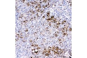 IHC analysis of GSTA1/A2/A3/A4/A5 using anti-GSTA1/A2/A3/A4/A5 antibody (ABIN5518995).