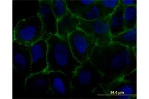 Immunofluorescence of monoclonal antibody to MCAM on U-2 OS cell. (MCAM Antikörper  (AA 1-646))