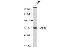 Western blot analysis of extracts of U-87MG cells using CAB39 Polyclonal Antibody at dilution of 1:1000. (CAB39 Antikörper)