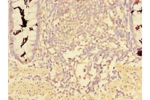 Immunohistochemistry of paraffin-embedded human colon tissue using ABIN7148068 at dilution of 1:100 (CCDC112 Antikörper  (AA 201-446))