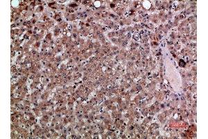 Immunohistochemical analysis of paraffin-embedded human-liver, antibody was diluted at 1:200 (CXCL12 Antikörper  (AA 31-80))