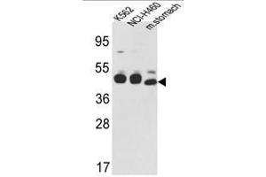 Image no. 1 for anti-Keratin 18 (KRT18) (C-Term) antibody (ABIN452897) (Cytokeratin 18 Antikörper  (C-Term))