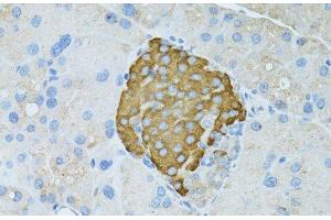 Immunohistochemistry of paraffin-embedded Rat pancreas using TEFM Polyclonal Antibody at dilution of 1:100 (40x lens). (TEFM Antikörper)