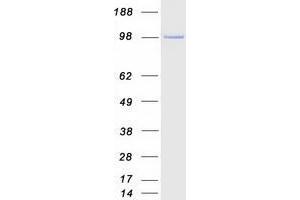 Western Blotting (WB) image for Janus Kinase 2 (JAK2) (full length) protein (Myc-DYKDDDDK Tag) (ABIN2734728)