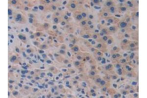 Immunohistochemistry (IHC) image for anti-Growth Hormone Releasing Hormone (GHRH) (AA 19-108) antibody (ABIN7425857)