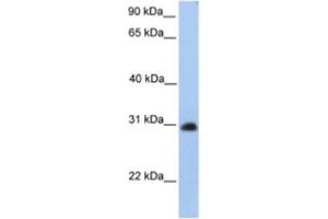 Western Blotting (WB) image for anti-Carbohydrate (N-Acetylgalactosamine 4-0) Sulfotransferase 14 (CHST14) antibody (ABIN2463248) (CHST14 Antikörper)