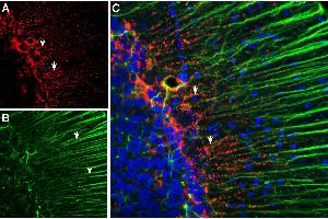 Multiplex staining of Connexin-43 and GFAP in rat cerebellum. (Glial Fibrillary Acidic Protein (GFAP) Peptid)