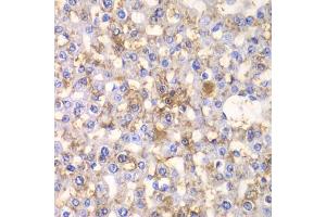 Immunohistochemistry of paraffin-embedded rat liver using HAPLN1 antibody. (HAPLN1 Antikörper)