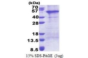 SDS-PAGE (SDS) image for Adaptor-Related Protein Complex 1 Associated Regulatory Protein (AP1AR) (AA 1-302) protein (His tag) (ABIN6387289) (AP1AR Protein (AA 1-302) (His tag))