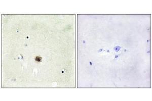 Immunohistochemistry analysis of paraffin-embedded human brain tissue using CSRP1 antibody. (CSRP1 Antikörper  (Internal Region))