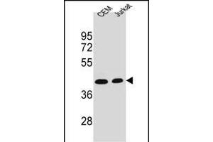 ADA Antibody (C-term) (ABIN1536621 and ABIN2843881) western blot analysis in CEM,Jurkat cell line lysates (35 μg/lane).