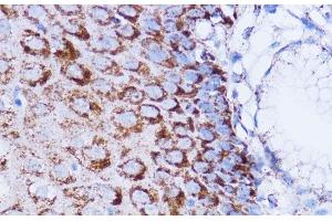 Immunohistochemistry (Paraffin-embedded Sections) (IHC (p)) image for anti-NADH Dehydrogenase (Ubiquinone) 1 beta Subcomplex, 7, 18kDa (NDUFB7) antibody (ABIN7257309)