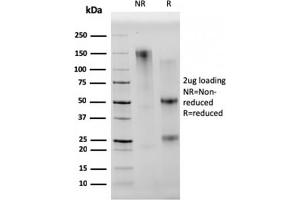SDS-PAGE Analysis Purified CD68 Mouse Monoclonal Antibody (C68/2501). (CD68 Antikörper  (AA 150-221))