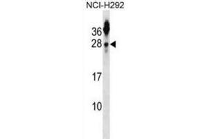 Western Blotting (WB) image for anti-Tetraspanin 2 (TSPAN2) antibody (ABIN2999038) (Tetraspanin 2 Antikörper)