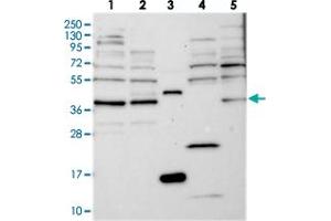 Western blot analysis of Lane 1: RT-4, Lane 2: U-251 MG, Lane 3: Human Plasma, Lane 4: Liver, Lane 5: Tonsil with FAXC polyclonal antibody  at 1:250-1:500 dilution. (C6orf168 Antikörper)