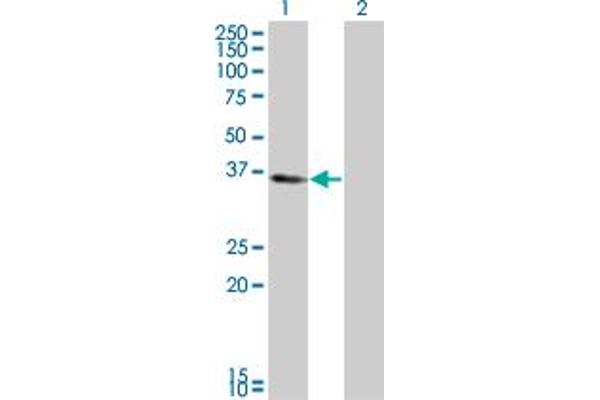 KLF6 anticorps  (AA 1-260)