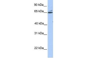 Western Blotting (WB) image for anti-Glutamic Pyruvate Transaminase (Alanine Aminotransferase) 2 (GPT2) antibody (ABIN2459251) (GPT2 Antikörper)