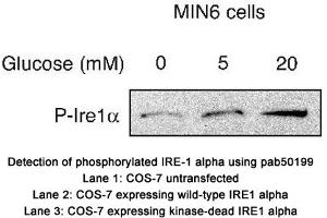 Image no. 2 for anti-Endoplasmic Reticulum To Nucleus Signaling 1 (ERN1) (pSer724) antibody (ABIN363508) (ERN1 Antikörper  (pSer724))