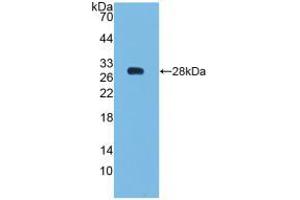 Western blot analysis of recombinant Human Bcl2. (Bcl-2 Antikörper  (AA 2-211))
